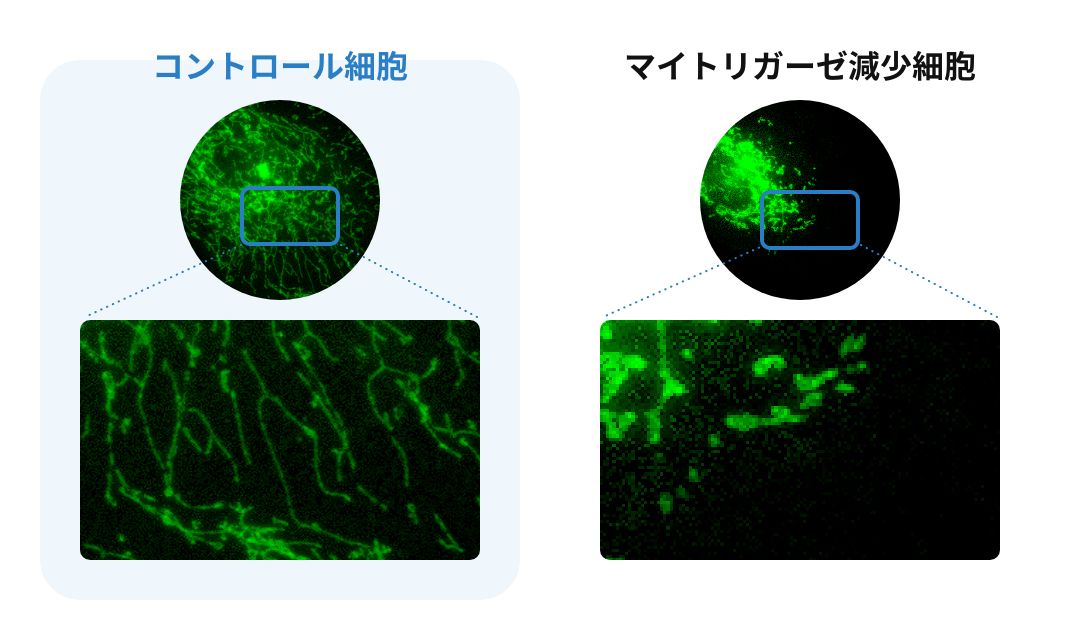 コントロール細胞とマイトリガーゼ減少細胞の比較図