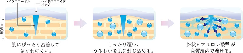 250110_クリニラボ_マイクロニードルパッチ_04.jpg