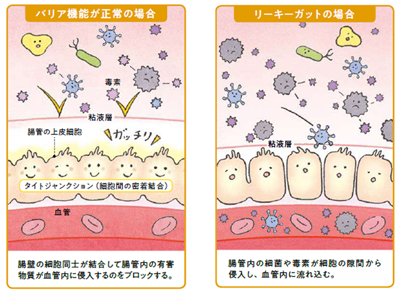 短鎖脂肪酸で腸内環境を整える 免疫力向上のススメ