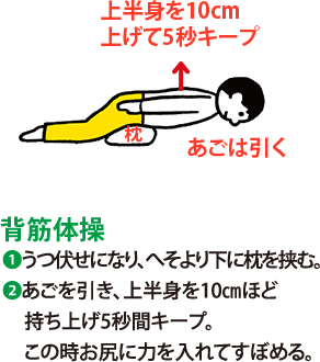 背筋体操:1 うつ伏せになり、へそより下に枕を挟む。 2 あごを引き、上半身を10㎝ほど持ち上げ5秒間キープ。この時お尻に力を入れてすぼめる。