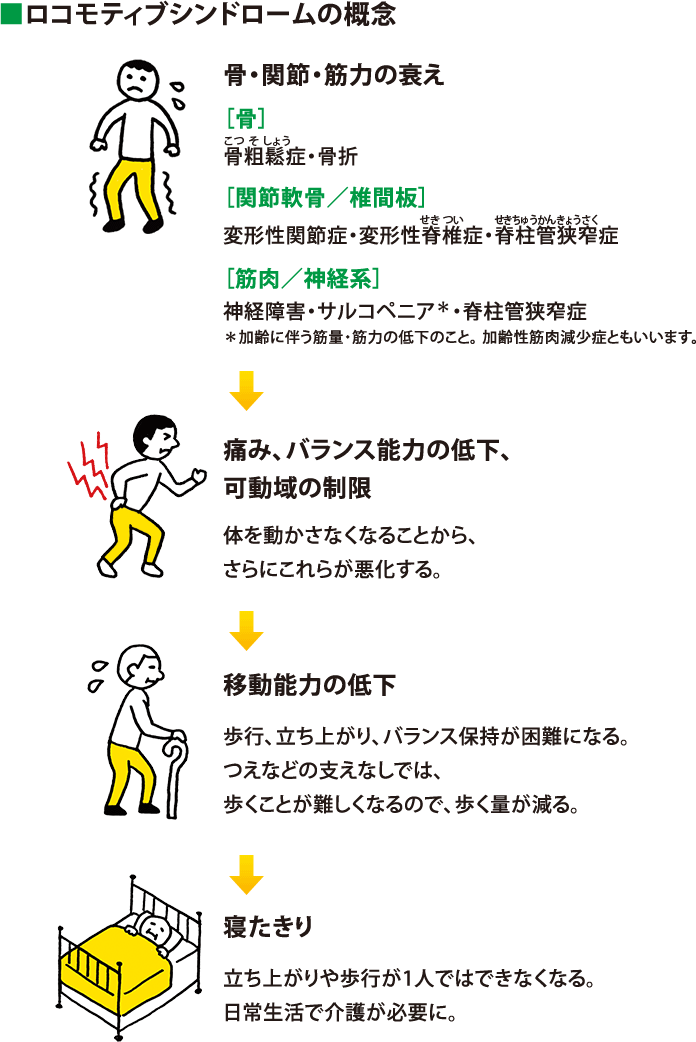 ロコモティブシンドロームの概念:骨・関節・筋力の衰え ［骨］骨粗鬆症・骨折［関節軟骨／椎間板］変形性関節症・変形性脊椎症・脊柱管狭窄症［筋肉／神経系］神経障害・サルコペニア（加齢に伴う筋量・筋力の低下のこと。 加齢性筋肉減少症ともいいます。）・脊柱管狭窄症→痛み、バランス能力の低下、可動域の制限 体を動かさなくなることから、さらにこれらが悪化する。→移動能力の低下 歩行、立ち上がり、バランス保持が困難になる。つえなどの支えなしでは、歩くことが難しくなるので、歩く量が減る。→寝たきり 立ち上がりや歩行が1人ではできなくなる。日常生活で介護が必要に。