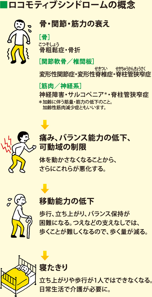 ロコモティブシンドロームの概念:骨・関節・筋力の衰え ［骨］骨粗鬆症・骨折［関節軟骨／椎間板］変形性関節症・変形性脊椎症・脊柱管狭窄症［筋肉／神経系］神経障害・サルコペニア（加齢に伴う筋量・筋力の低下のこと。 加齢性筋肉減少症ともいいます。）・脊柱管狭窄症→痛み、バランス能力の低下、可動域の制限 体を動かさなくなることから、さらにこれらが悪化する。→移動能力の低下 歩行、立ち上がり、バランス保持が困難になる。つえなどの支えなしでは、歩くことが難しくなるので、歩く量が減る。→寝たきり 立ち上がりや歩行が1人ではできなくなる。日常生活で介護が必要に。