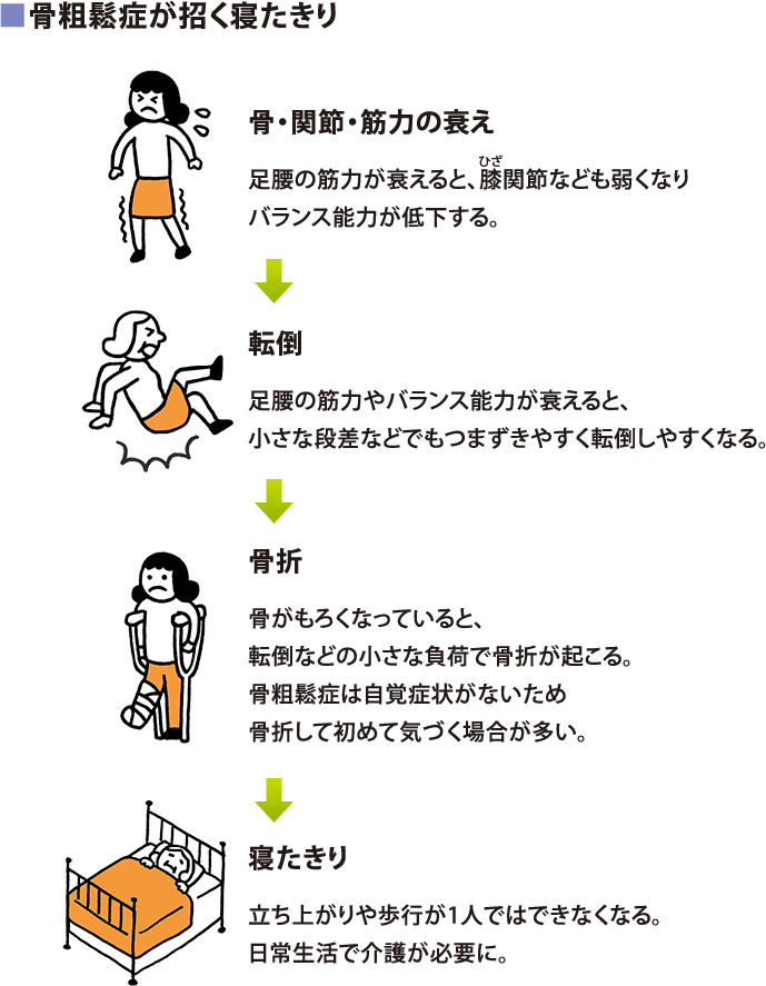 骨粗鬆症が招く寝たきり:骨・関節・筋力の衰え:足腰の筋力が衰えると、膝関節なども弱くなりバランス能力が低下する。→転倒:足腰の筋力やバランス能力が衰えると、小さな段差などでもつまずきやすく転倒しやすくなる。→骨折:骨がもろくなっていると、転倒などの小さな負荷で骨折が起こる。骨粗鬆症は自覚症状がないため骨折して初めて気づく場合が多い。→寝たきり:立ち上がりや歩行が1人ではできなくなる。日常生活で介護が必要に。