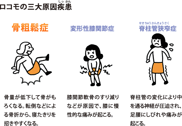 ロコモの三大原因疾患:骨粗鬆症(骨量が低下して骨がもろくなる。転倒などによる骨折から、寝たきりを招きやすくなる。)、変形性膝関節症(膝関節軟骨のすり減りなどが原因で、膝に慢性的な痛みが起こる。)、脊柱管狭窄症(脊柱管の変化により中を通る神経が圧迫され、足腰にしびれや痛みが起こる。)