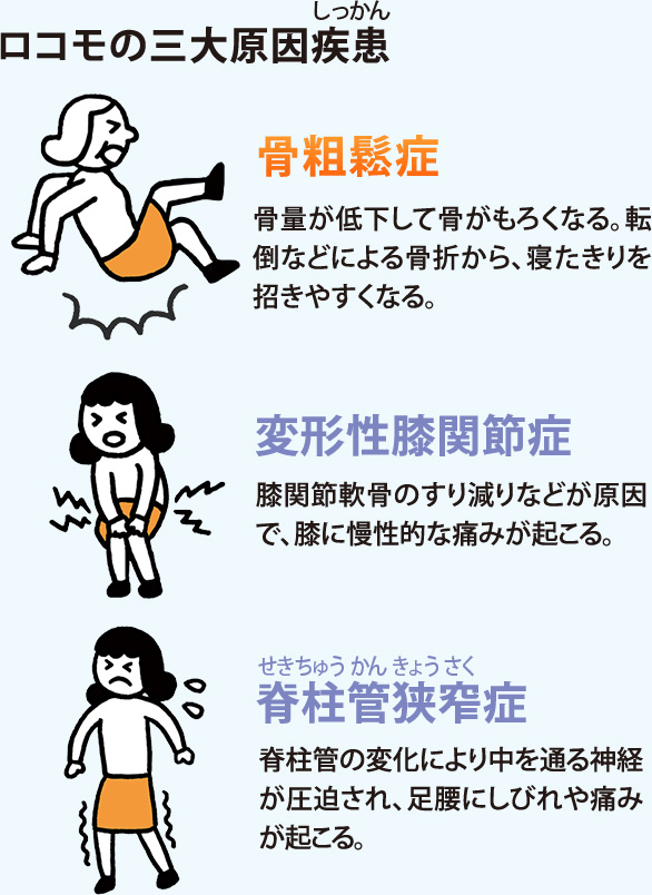 ロコモの三大原因疾患:骨粗鬆症(骨量が低下して骨がもろくなる。転倒などによる骨折から、寝たきりを招きやすくなる。)、変形性膝関節症(膝関節軟骨のすり減りなどが原因で、膝に慢性的な痛みが起こる。)、脊柱管狭窄症(脊柱管の変化により中を通る神経が圧迫され、足腰にしびれや痛みが起こる。)
