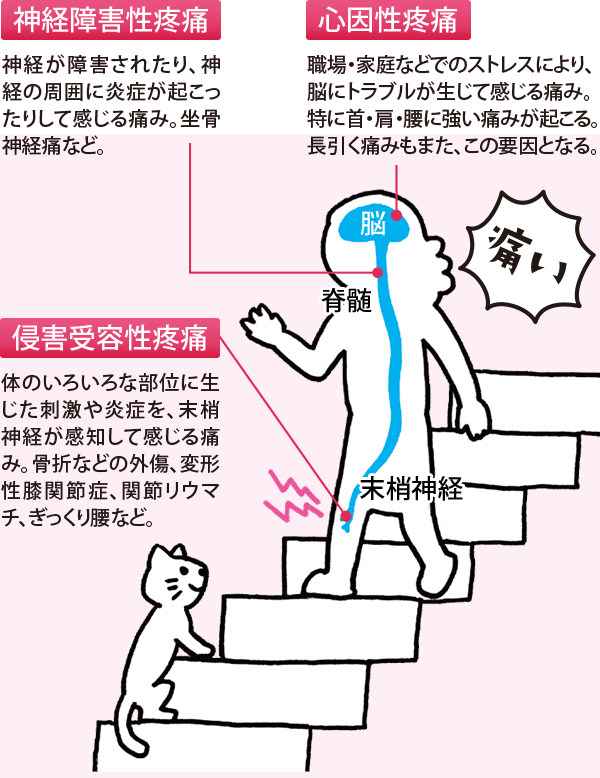 痛み はどうして起こるの 1からわかるロコモ 膝痛 腰痛編 大正製薬株式会社