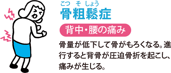 骨粗鬆（こつそしょう）症:背中・腰の痛み　骨量が低下して骨がもろくなる。進行すると背骨が圧迫骨折を起こし、痛みが生じる。