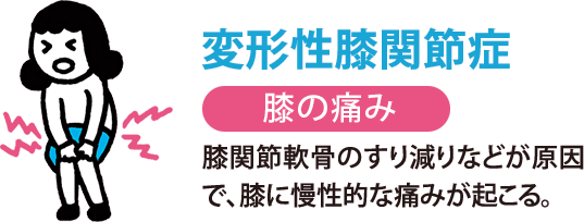 変形性膝関節症:膝の痛み　膝関節軟骨のすり減りなどが原因で、膝に慢性的な痛みが起こる。